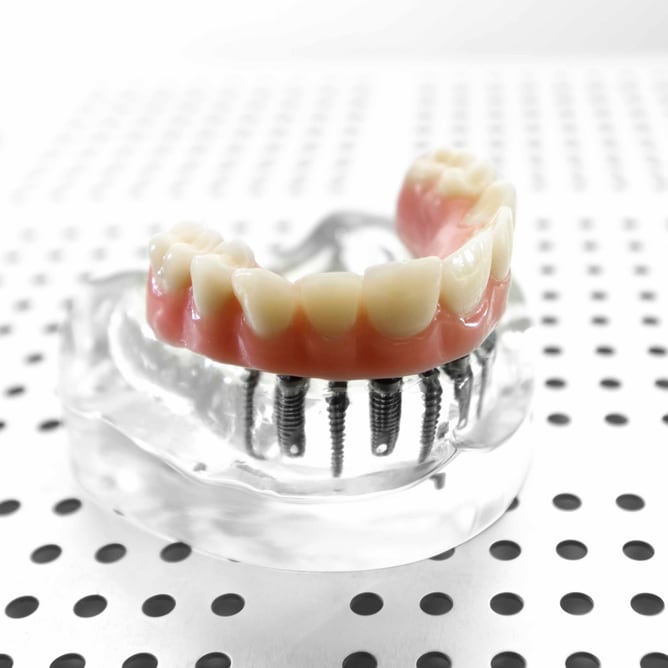 Customised dentures service at Villa Dental